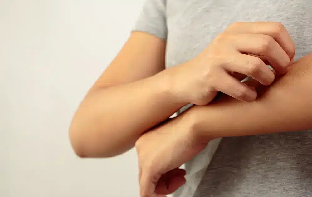 como reconhecer a psoriase